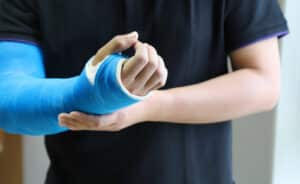 Closeup of asian man's arm with long arm plaster