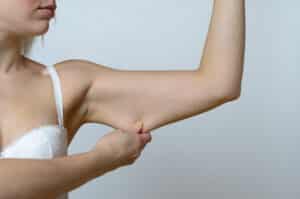 A close-up shot of a woman pulling down loose skin on her upper arm