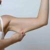 A close-up shot of a woman pulling down loose skin on her upper arm